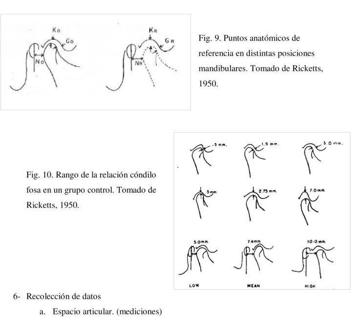 Fig. 10. Rango de la relación cóndilo  fosa en un grupo control. Tomado de  Ricketts, 1950