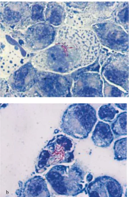 Fig.  5.  Infección  de  monocapa  de  macrófagos  THP-1  con  la  suspensión  unicelular  de  N
