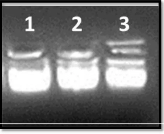 Figura 6. Extracción de ADN. Comprobación de la recuperación de material genómico de los tres  individuos de estudio