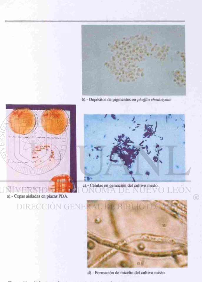 Figura JO.- Aislamiento de microorganismos (a) y observaciones  en el microscopio histológico (bx.d)