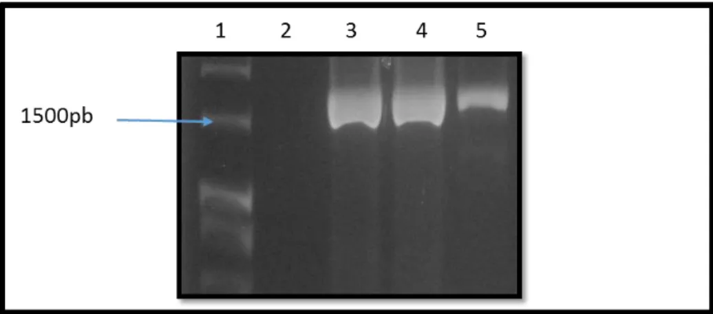 Figura 4. Electroforesis en gel de agarosa 1.5 % de RT-PCR de la subunidad VP5* de Rotavirus