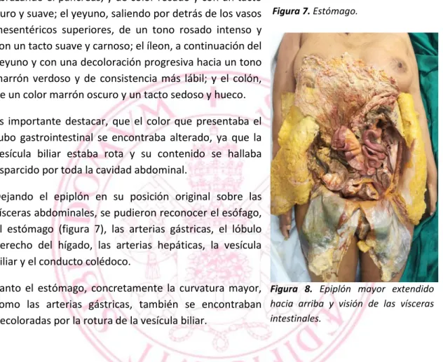 Figura 7. Estómago.  