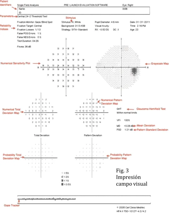 Fig. 3  Impresión  campo visual 