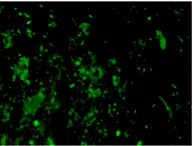 Figura 4. ASC marcadas con anti CD 105, donde se visualiza su citoplasma teñido  en verde