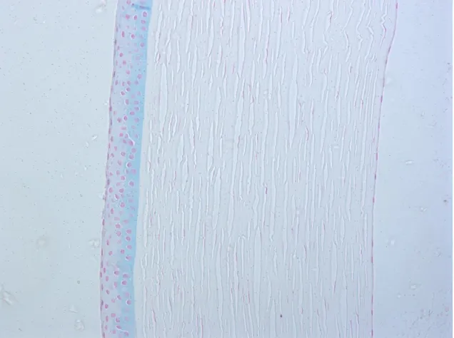 Figura 4. Tinción de Perls de la muestra 10B56 en la que se evidencian depósitos de  hierro en el epitelio central de la córnea