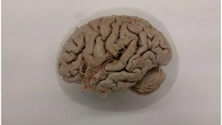 Foto 1. Cerebro
