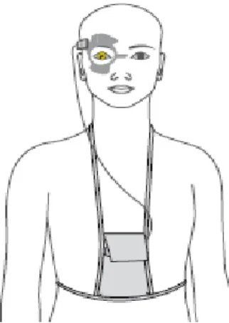Fig 2. Componentes del sistema Triggerfish® 