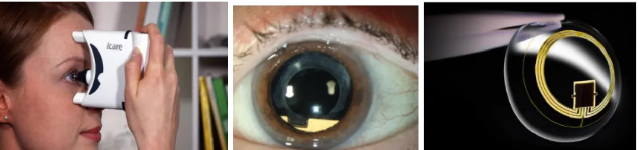 Fig 1. (de izda a dcha) Dispositivos Icare® Home, EyeMate® y Triggerfish® 