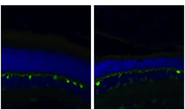 Fig 10: Comparación de las IF con el anticuerpo anti-calbindina (verde) en  los ratones WT