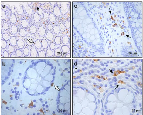 Fig. 3 ApoD protein expression in normal colon tissue. Mesenchymal cells express ApoD in normal mucosa (arrows in a, c, and d) and a small number of possibly enteroendocrine cells show ApoD labeling in the colonic crypts (white arrows in a and b)