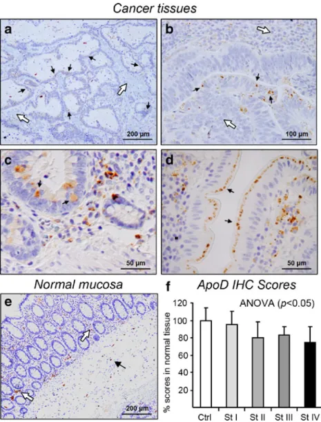 Fig. 4 Human ApoD is globally down-regulated in  co-lorectal tumors but shows  het-erogeneous changes of expression in different cell types