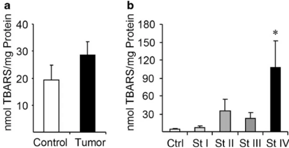 Fig. 1 Lipid peroxidation increases in terminal stages of colorectal cancer. a The levels of lipid peroxidation adducts, assayed by TBARS, increase in colorectal tumor tissue of pooled stages compared to control healthy mucosa tissue