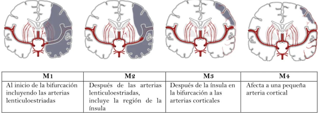 Figura 7      Clasificación de la irrigación por segmentos de la ACM  