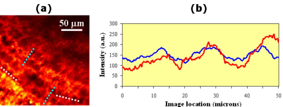 Fig. 10. (a) Examples of locations across the nonlinear microscopy image of an ablated chicken  cornea (pattern #1) where the intensity profile was computed