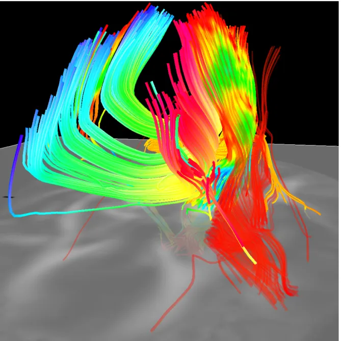 Figure 3.6: An example of deterministic tractography.