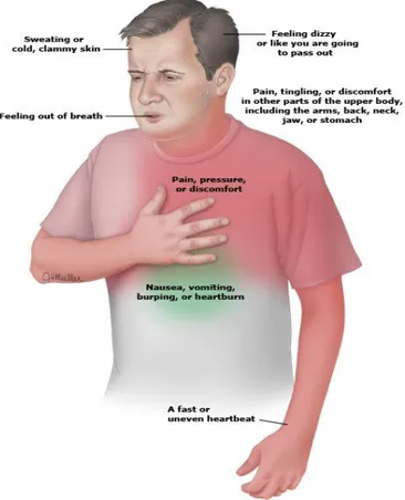 Figura  5.  Se  observa  el  gesto  típico  de  pacientes  que  sufren  un  IAM  o  una  angina
