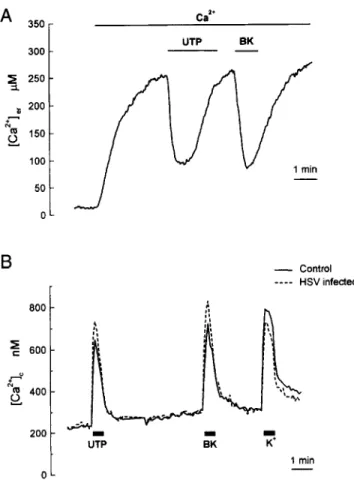 Fig.  3  Comparison  between  the  effect  of  histamine  on  [Ca2+ler  in  pHSVerAEQ-infected  HeLa  ceils  (A)  and  in  the  HeLa  EM26  clone  (B)