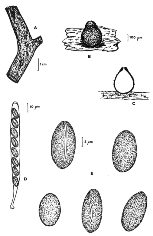 Figura 6.- Coniochaeta malacotricha:  A.  aspecto general de los peritecios sobre la madera, B