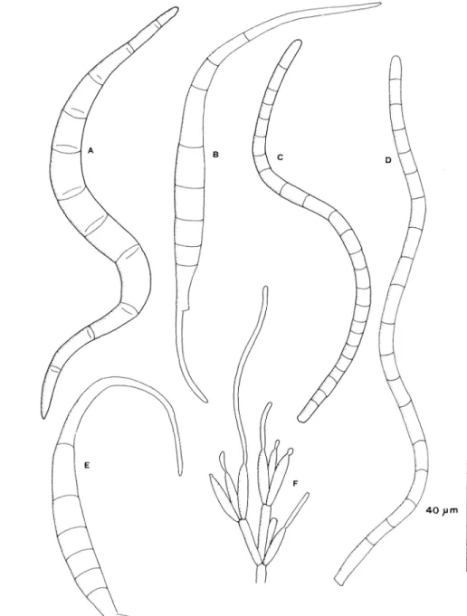 Figura 4 A-B: Tricladium robustum, C-D: ? Varicosporium delicatum, E-F: Tricladium patulum, G-I: Taeniospora gracilis (B = escala &#34;a&#34;, resto = escala &#34;b&#34;).
