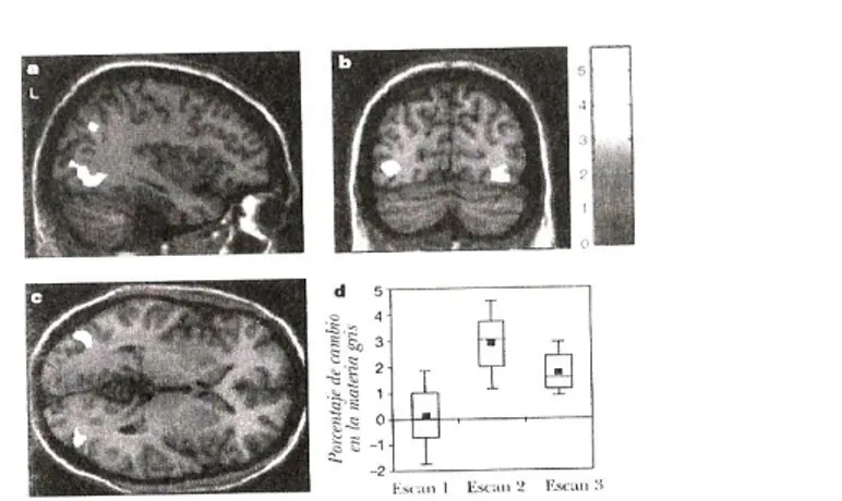 Figura 3. Las zonas iluminadas muestran el aumento de las regiones cerebrales potenciadas  durante la práctica de malabares
