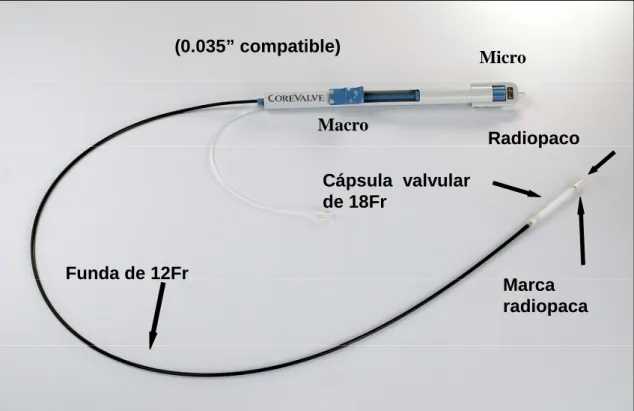 Figura 3.8. Dispositivo de liberación Funda de 12Fr  Cápsula  valvular de 18Fr  Radiopaco Marca  radiopaca  (0.035” compatible) Macro Micro 