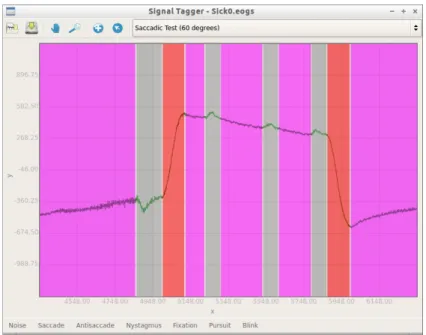 Fig. 2. Signal editor main window. Pink segments mean fixations, gray segments mean noise and red segments mean saccades.