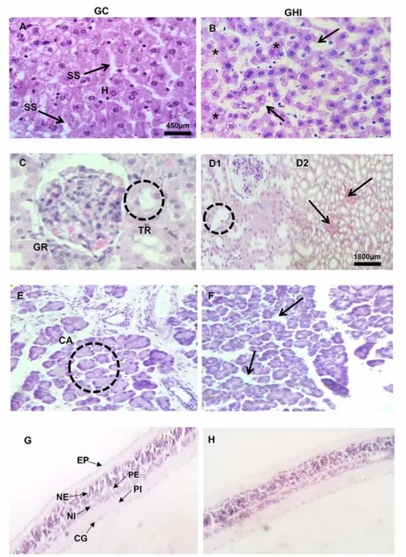 Figura 2. Cambios histológicos del hígado, el riñón, el páncreas y la retina. (A) microfotografías 