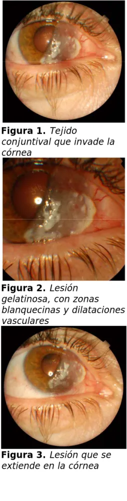 Figura 1. Tejido 