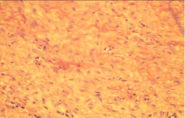 Figura 5.  Examen microscópico: son visibles bandas de colágeno y células 