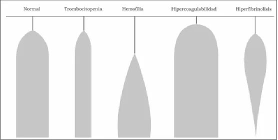 Figura 9: Diferentes patrones tromboelastográficos. 