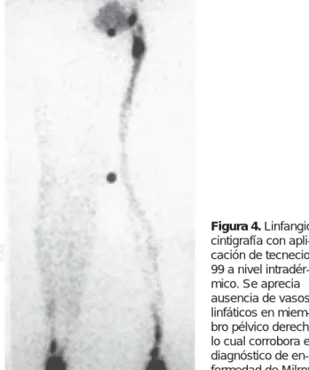 Figura 4. Linfangio-