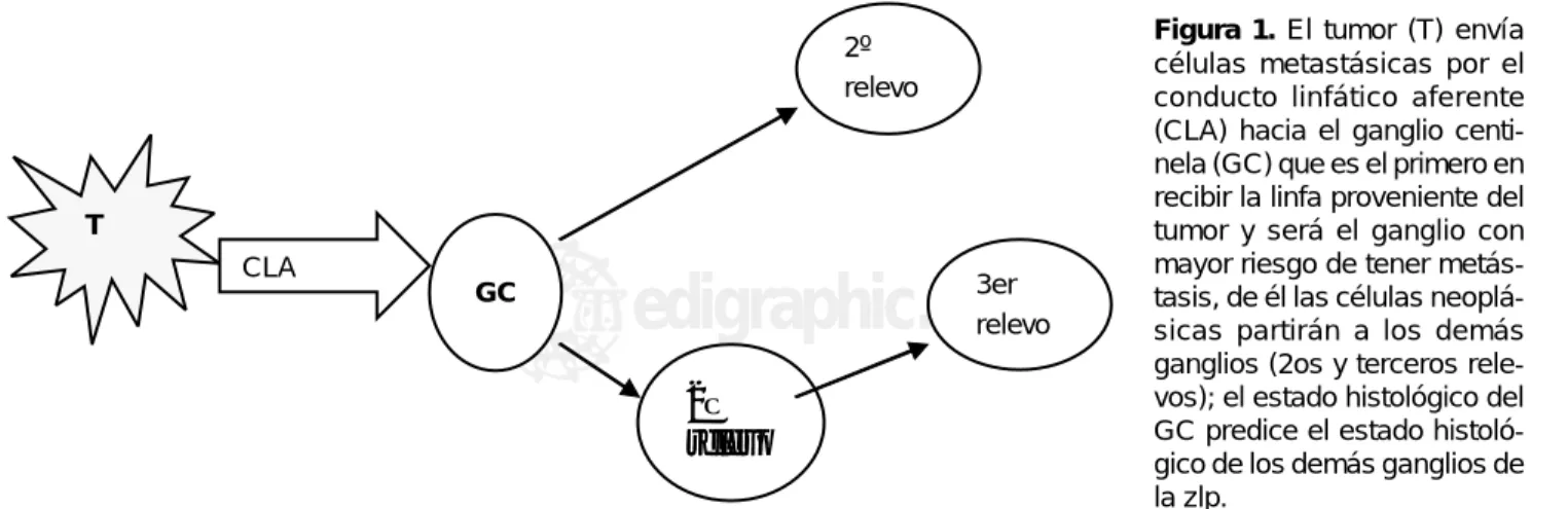 Figura 1. El tumor (T) envía
