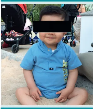 Figura 4.  Paciente al año de vida.