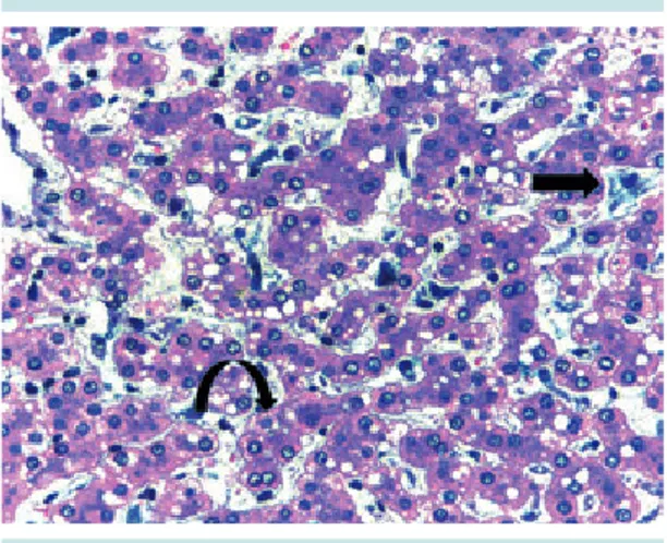 Figura 7.  Corte histológico del parénquima hepático:  siderosis leve en células de Kupffer (tinción en azul  flecha) y en algunos hepatocitos (flecha curva)