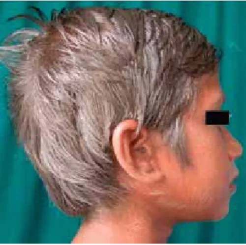 Figura 9. cabello plateado. 