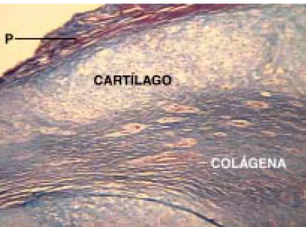 Figura 1. Foto micrografía en la que se observa el PBTGL (P),