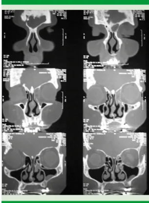 Figura 4. Imágenes preoperatorias.