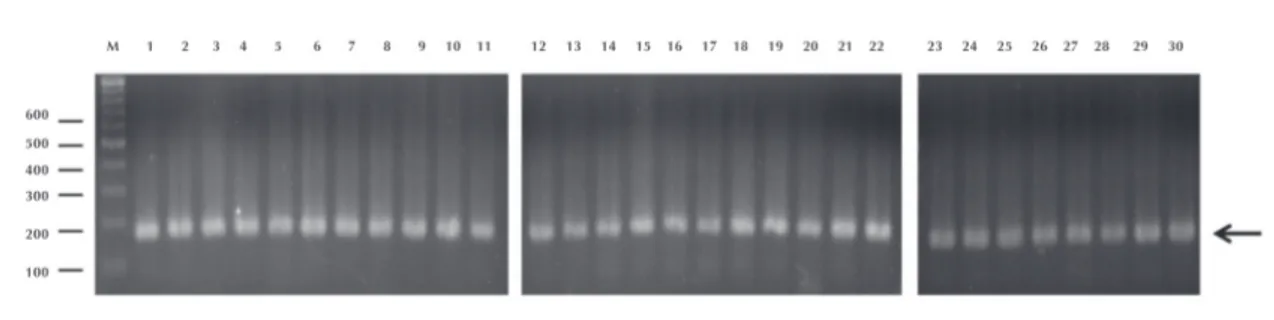 Figura 3.  Amplificación del gen Nod1 por la reacción en cadena de la polimerasa a partir de ADN genómico de  tejido amigdalino