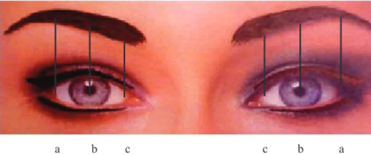 Figura 1. Áreas medidas antes y después del tratamiento de Botox.