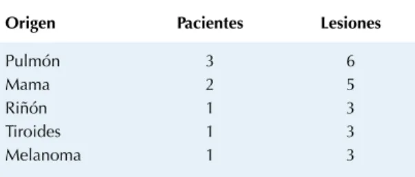 Cuadro 3.  Realce de las lesiones metastásicas en el estudio  basal