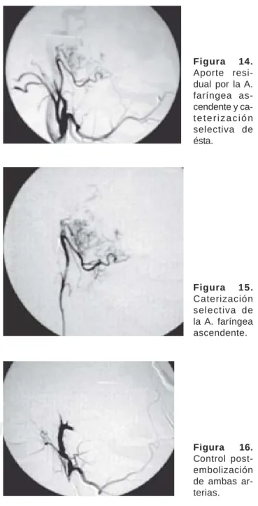 Figura 12. Ca-