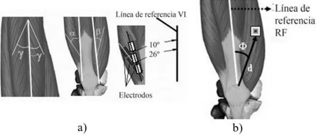 Figura 12 a) Posición longitudinal de los electrodos b) Ángulos de orientación de los electrodos [34] 