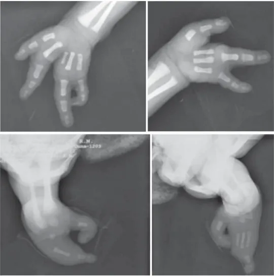 Figura 3. Radiografías de manos y 