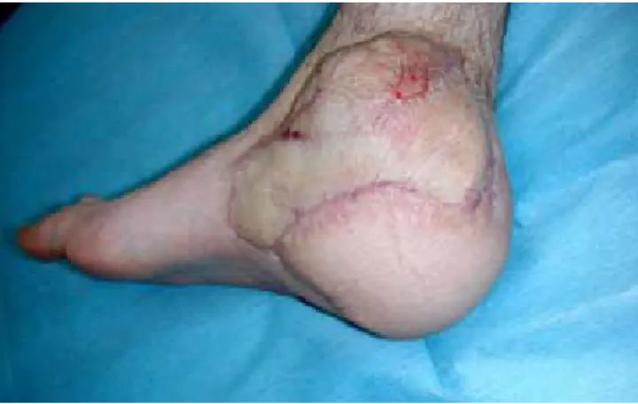 Figura 9. Estado postoperatorio actual.