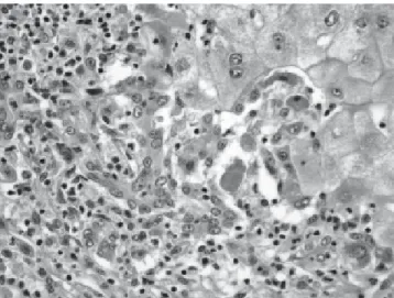 Figure 2. Microphotography of the liver of a patient with