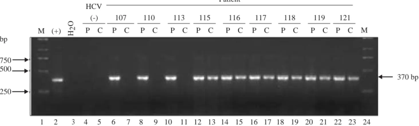 Figure 1. Detection of HCV RNA in plasma (P) samples and PBMCs (C) of infected patients (lanes 6 through 23)