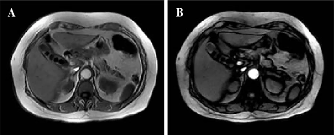 Figure 3. Magnetic resonance