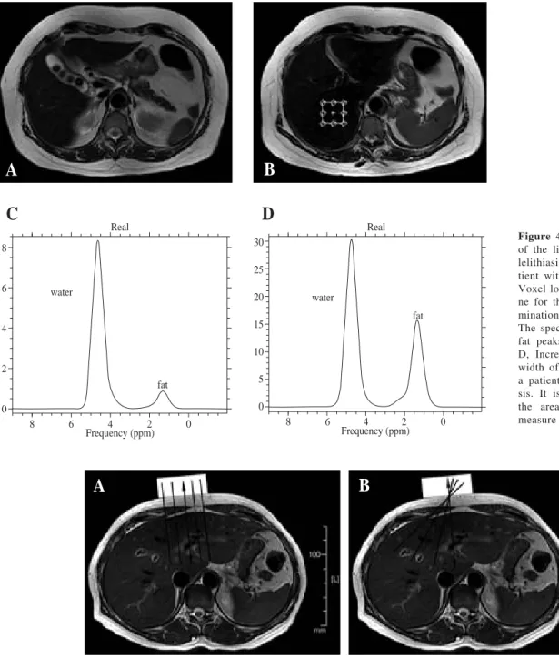Figure 5. Schematic representation of image generation in MR elastography. The double-headed