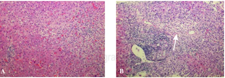 Figure 1A. H&amp;E (4X) stain of the initial liver biopsy showing minimal portal inflammation while the second biopsy