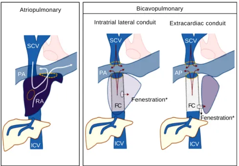 Table 1. Systemic consequences of the “failure” of the Fontan circulation.